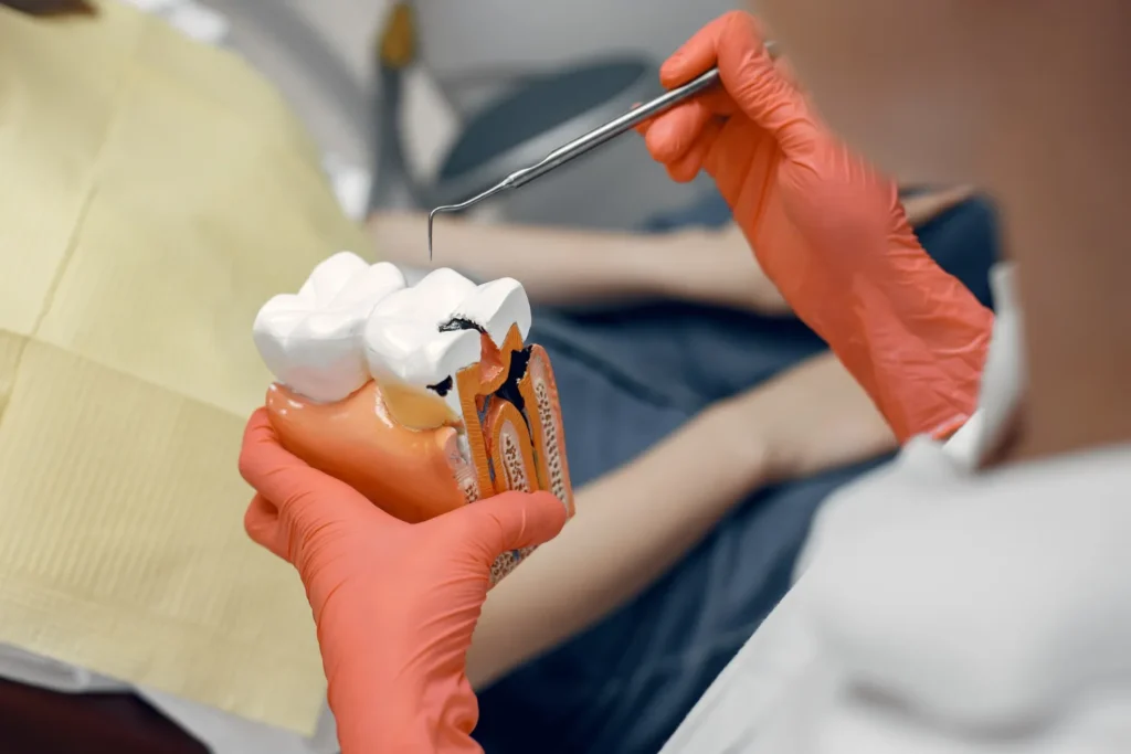 Causes of Cavities