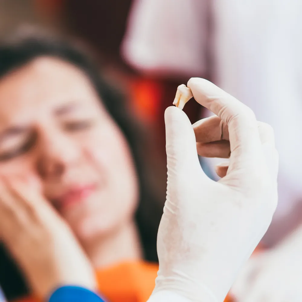 Tooth Extractions